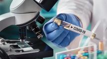 Covid-19: Confira os dados atualizados do novo coronavírus em Betim nesta terça (22)
