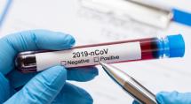 Covid-19: Confira os dados atualizados do novo coronavírus em Betim nesta terça-feira (15)