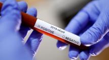 Covid-19: Confira os dados atualizados do novo coronavírus em Betim neste sábado (17)